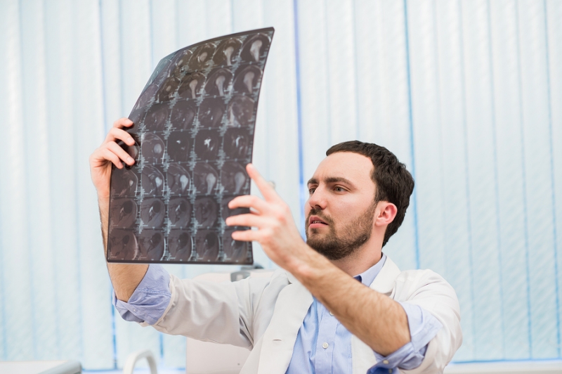 Physician reading and reviewing a MRI brain scan